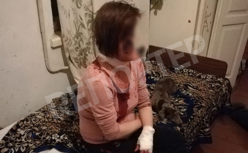 В Днепре женщине едва не отрубили голову топором, преступник задержан
