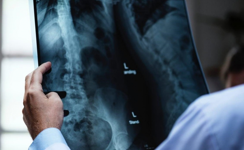Больницы Днепропетровщины получили новые рентген-аппараты