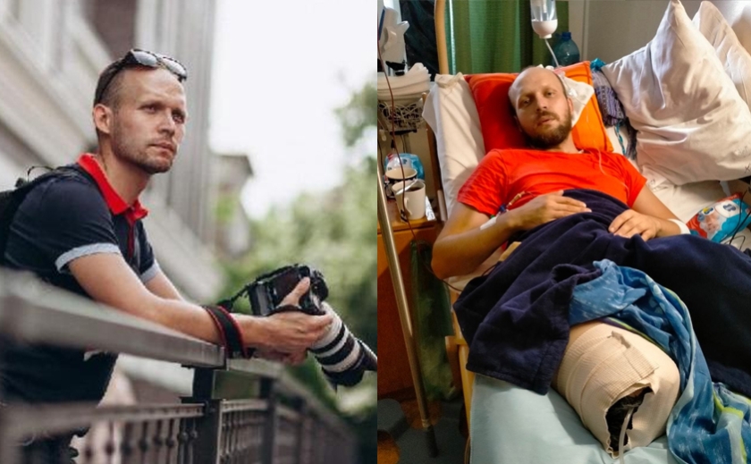 Пішов добровольцем: фотограф із Дніпра втратив ногу на фронті