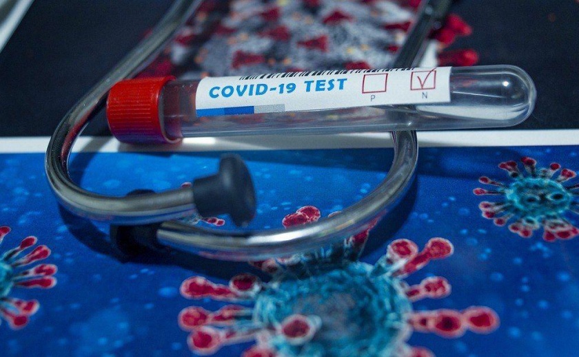 Появились новые цифры по заболеваемости на COVID-19 в Днепре за последние сутки