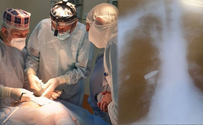 Куля застрягла в легенях: у Дніпрі провели унікальну операцію та врятували життя Герою