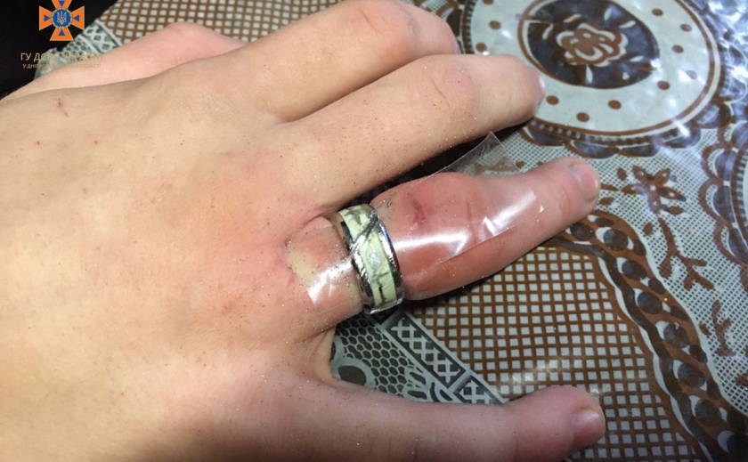 В Дніпрі надзвичайники допомогли хлопцеві зняти каблучку з пальця В Дніпрі надзвичайники допомогли хлопцеві зняти каблучку з пальця