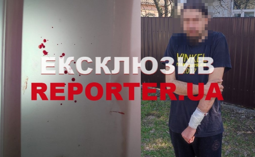 Включив газ, наковтався пігулок та порізав вени: у Дніпрі чоловік намагався вкоротити собі віку