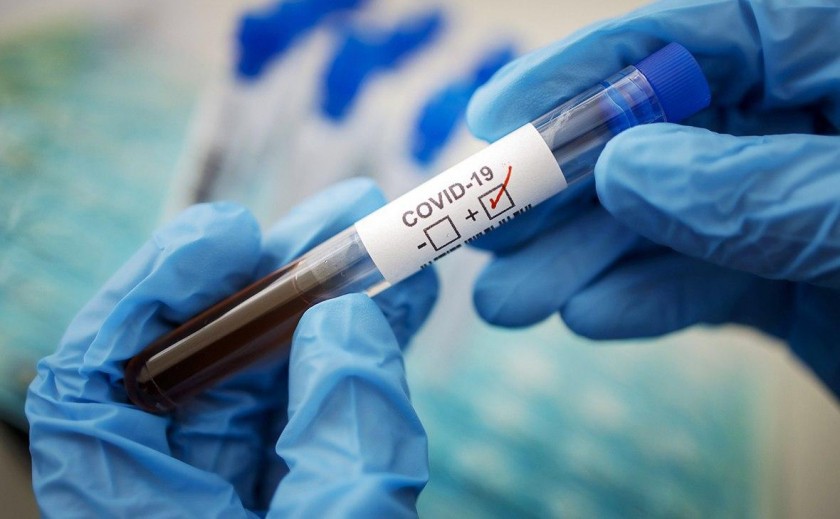 В Днепре пять человек заразились COVID-19