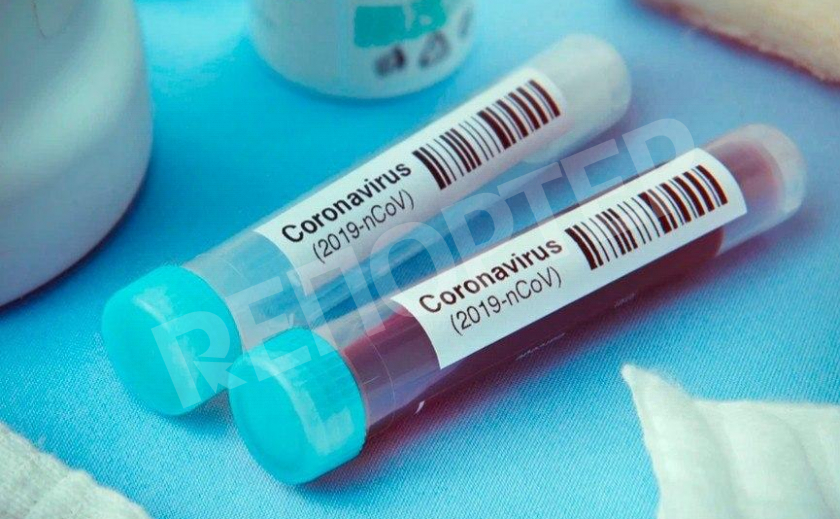 В Днепре за сутки коронавирусом заболели два человека