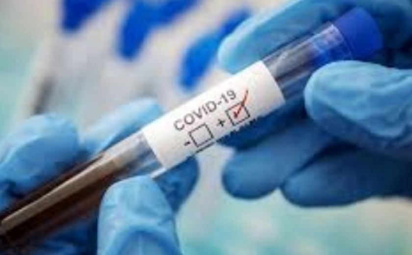На Дніпропетровщині знизився рівень захворюваності на COVID-19