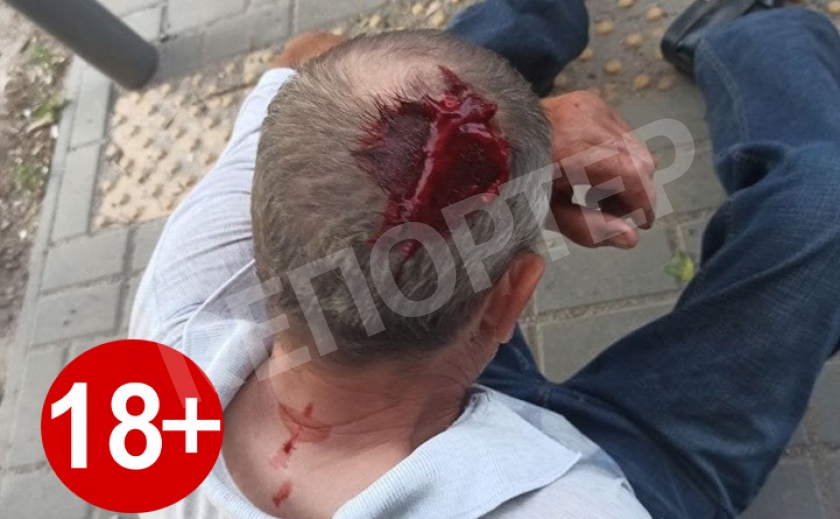 Выбросили из маршрутки и напали на полицейских. В Днепре развернулась «война» за перевозчика