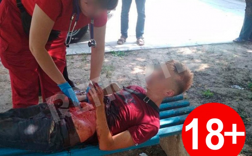 В лесополосе Днепра парень вспорол себе живот разбитой бутылкой 18+