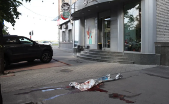 У Дніпрі на Воскресенській з вікна багатоповерхівки випала людина: подробиці