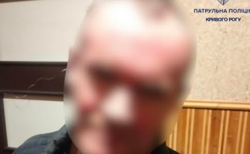 На Криворіжжі необдуманий вчинок чоловіка закінчився штрафом у 850 гривень