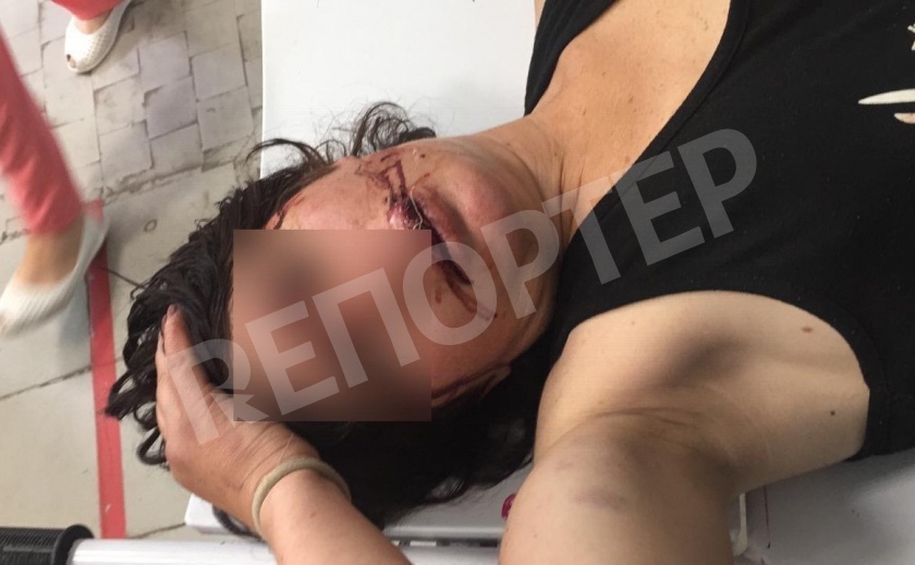 В самом центре Днепра злоумышленник жестоко избил женщину 18+ В самом центре Днепра злоумышленник жестоко избил женщину 18+