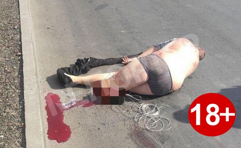В жуткой автокатастрофе днепрянину оторвало ногу 18+