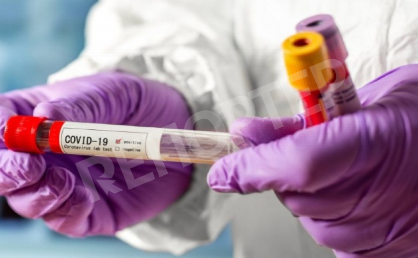 В Днепре выявили двадцать один случай заражения коронавирусом за сутки