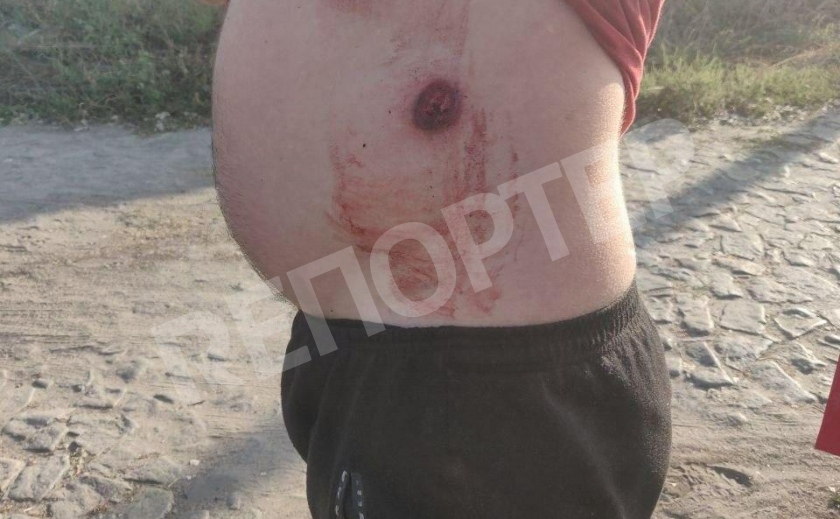 В Днепре выясняют отношения с помощью пистолета