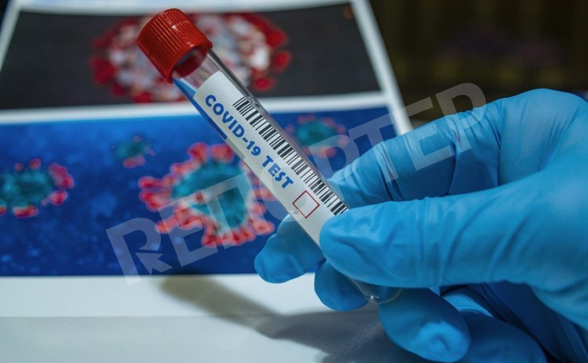 Инфекционисты Днепра комментируют ситуацию с заболеваемостью коронавирусом