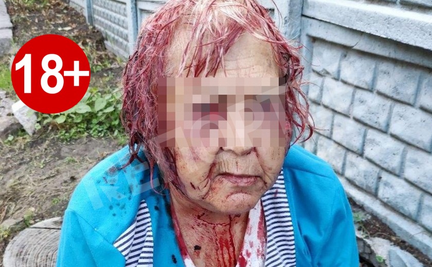 В Днепре стафф едва не убил пенсионерку 18+
